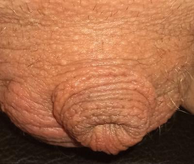 Tinydicklee